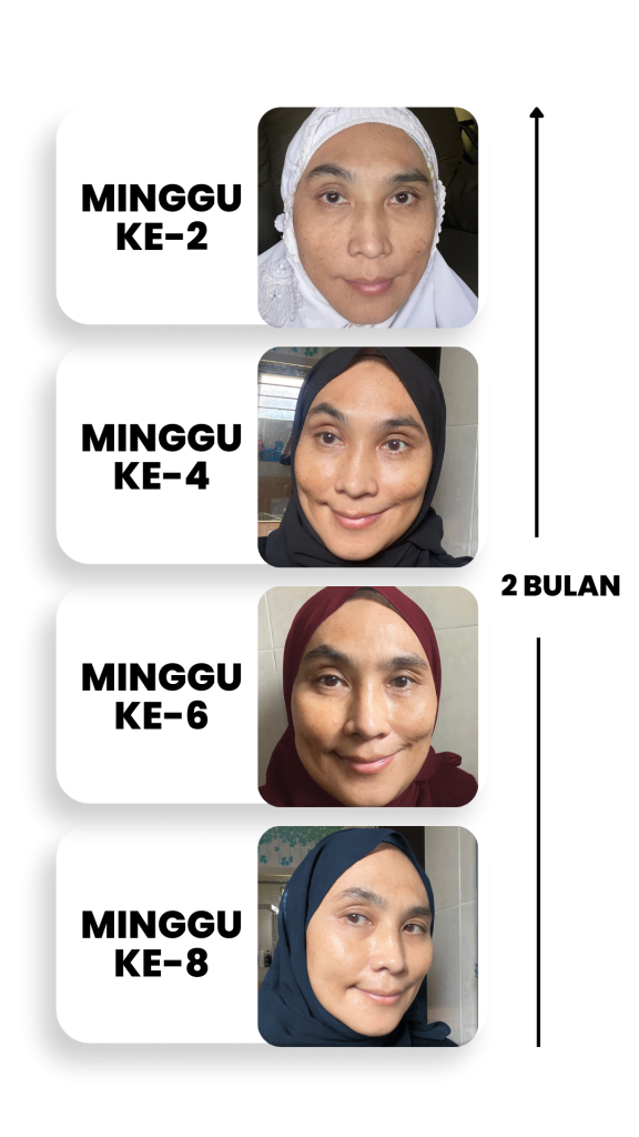 Melasma-Care-Testimoni-Pengguna